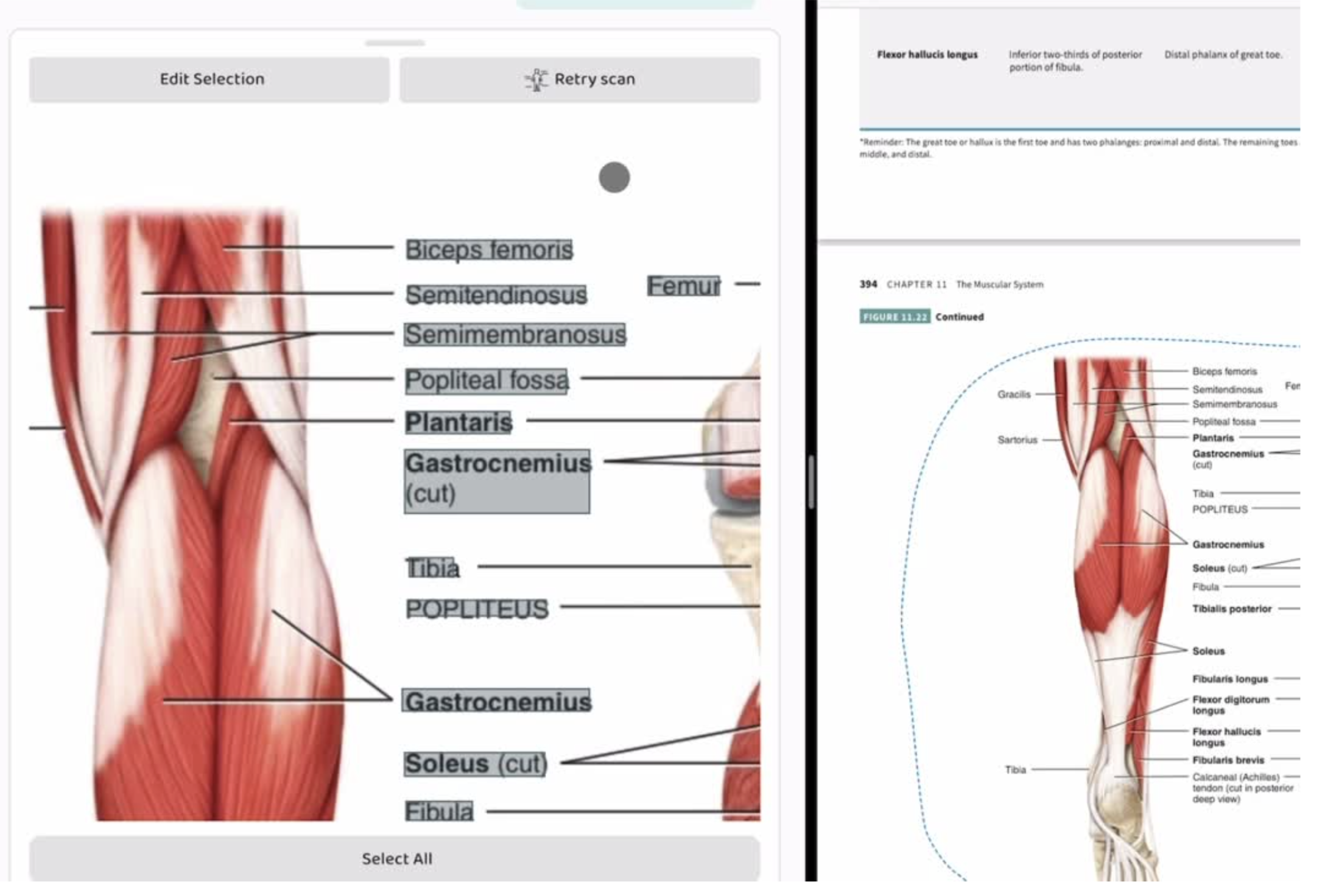 ai image occlusion flashcard